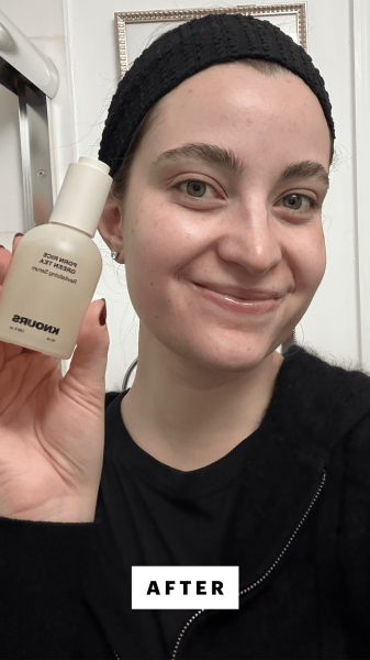Felbin after applying the Knours PDRN Rice Green Tea Revitalizing Serum